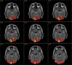 fmri1